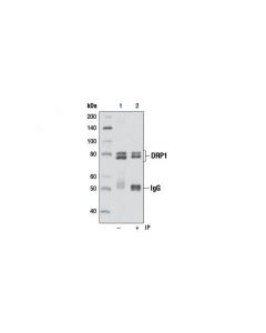 Cell Signaling Drp1 (D8h5) Rabbit mAb