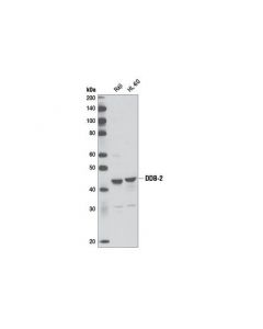 Cell Signaling Ddb-2 (D4c4) Rabbit mAb