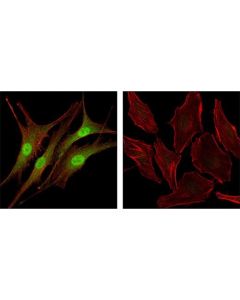 Cell Signaling Livin (D61d1) Xp Rabbit mAb