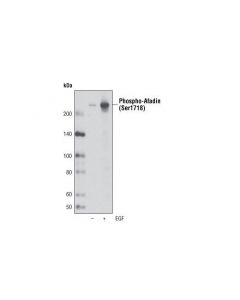 Cell Signaling Phospho-Afadin (Ser1718) Antibody