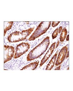 Cell Signaling Epcam (D9s3p) Rabbit mAb (Ihc Preferred) (Bsa And Azide Free)