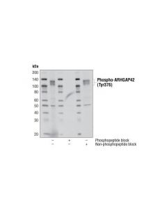 Cell Signaling Phospho-Arhgap42 (Tyr376) (D45e9) Rabbit mAb