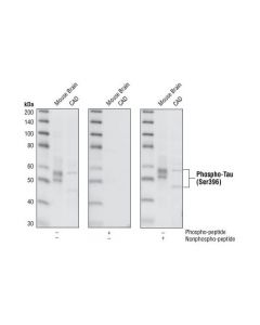 Cell Signaling Phosphoplus Tau (Ser396) Antibody Duet