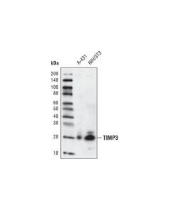 Cell Signaling Timp3 (D74b10) Rabbit mAb