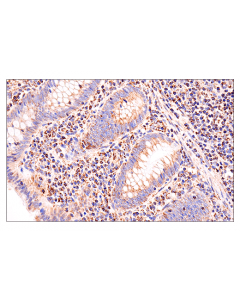 Cell Signaling Glutaminase-1/Gls1 (E9h6h) Xp Rabbit mAb