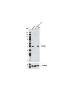 Cell Signaling Pka Ri-Alpha (D54d9) Rabbit mAb