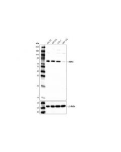 Cell Signaling Imp3 (D6u2n) Rabbit mAb