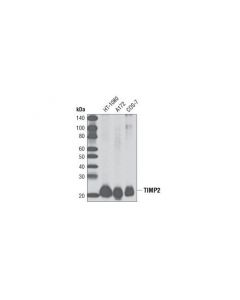 Cell Signaling Timp2 (D18b7) Rabbit mAb