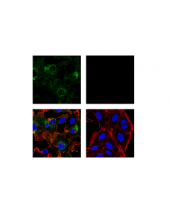 Cell Signaling Cd10/Neprilysin (E9z2w) Rabbit mAb