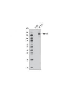 Cell Signaling Egf Receptor (E746-A750del Specific) (D6b6) Xp Rabbit mAb (Biotinylated)