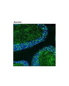 Cell Signaling Gad2 (D5g2) Xp Rabbit mAb