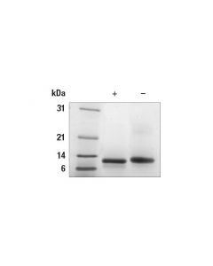 Cell Signaling Human Ctgf Recombinant Protein