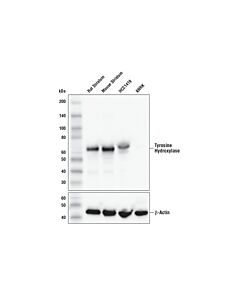 Cell Signaling Tyrosine Hydroxylase (E2L6M) Rabbit mAb