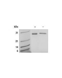 Cell Signaling Human Galectin-3/Lgals3 Recombinant Protein