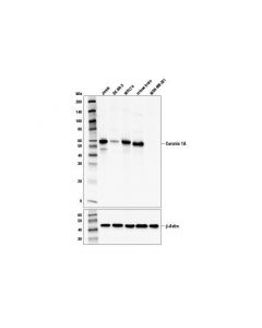Cell Signaling Coronin 1a (D7m3n) Rabbit mAb