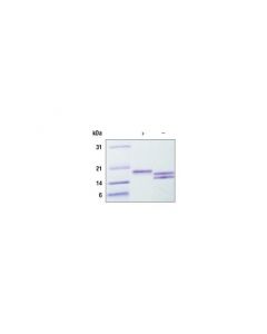 Cell Signaling Human Il-33 Recombinant Protein