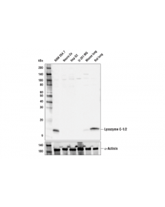 Cell Signaling Lysozyme C-1/2 Antibody