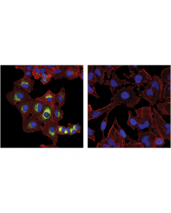 Cell Signaling Muc5ac (E3o9i) Xp Rabbit mAb