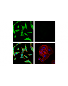 Cell Signaling Androgen Receptor Antibody Sampler Kit