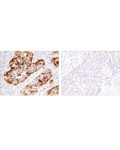 Cell Signaling Napsin A (D5p6g) Xp Rabbit mAb