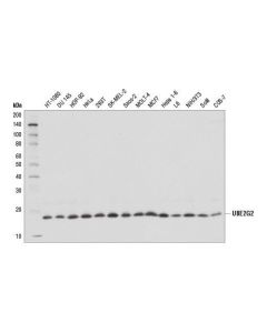 Cell Signaling Ube2g2 (D8z4g) Rabbit mAb