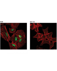 Cell Signaling Mll2/Kmt2b (D6x2e) Rabbit mAb (Carboxy-Terminal Antigen)