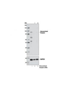 Cell Signaling Signalsilence Glucocorticoid Receptor Sirna I