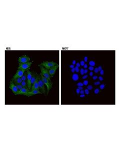 Cell Signaling Endophilin-1 (E1e6q) Rabbit mAb
