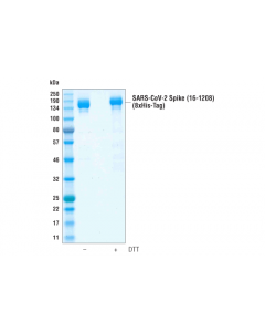 Cell Signaling Sars-Cov-2 Spike (Trimeric) (16-1208) Recombinant Protein (8xhis-Tag)