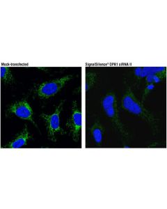 Cell Signaling Opa1 (D7c1a) Rabbit mAb