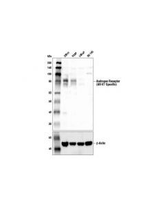 Cell Signaling Androgen Receptor (Ar-V7 Specific) Antibody