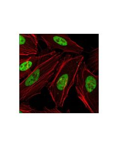 Cell Signaling Rbap46 (V415) Antibody