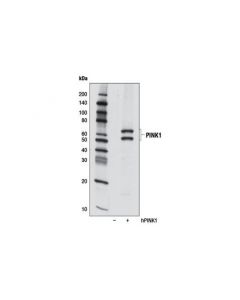 Cell Signaling Pink1 (D8g3) Rabbit mAb