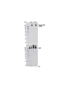 Cell Signaling Phospho-Egf Receptor (Tyr845) (D63b4) Rabbit mAb