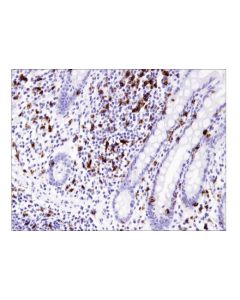 Cell Signaling Cd8alpha (C8/144b) Mouse mAb (Ihc Specific)