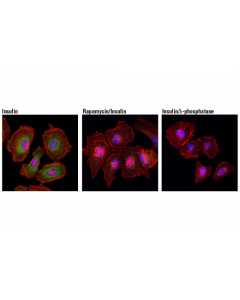 Cell Signaling Phospho-Cad (Ser1859) (D5o6c) Rabbit mAb