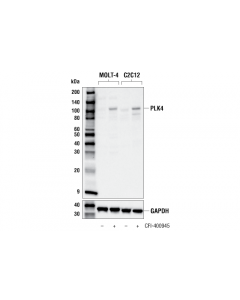 Cell Signaling Plk4 (E6a7r) Rabbit mAb