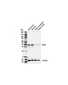 Cell Signaling Olig2 (E6g6q) Xp Rabbit mAb (Bsa And Azide Free)