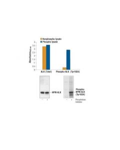 Cell Signaling Pathscan Phospho-Alk (Tyr1604) Sandwich Elisa Kit