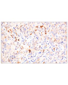 Cell Signaling Timp1 (D10e6) Rabbit mAb (Bsa And Azide Free)