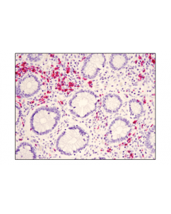 Cell Signaling Signalstain Vibrant Red Alkaline Phosphatase Substrate Kit