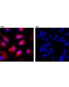 Cell Signaling Vimentin (D21h3) Xp Rabbit mAb (Alexa Fluor 594 Conjugate)