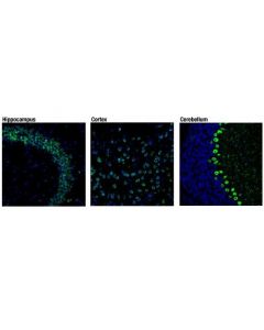 Cell Signaling Sorl1 (D8d4g) Rabbit mAb