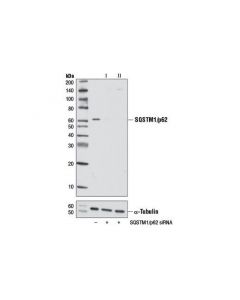 Cell Signaling Sqstm1/P62 (D5e2) Rabbit mAb