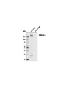Cell Signaling Pdgf Receptor Beta (28e1) Rabbit mAb (Biotinylated)