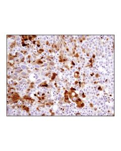 Cell Signaling Signalstain Dab Substrate Kit