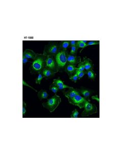 Cell Signaling Dr5 (D4e9) Xp Rabbit mAb