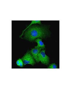 Cell Signaling Atg16l1 (D6d5) Rabbit mAb