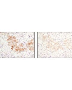 Cell Signaling Signalstain Antibody Diluent