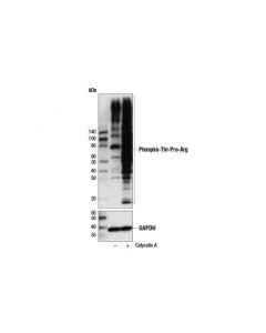 Cell Signaling Phospho-Thr-Pro-Arg Motif [Ptpr] Multimab Rabbit mAb Mix